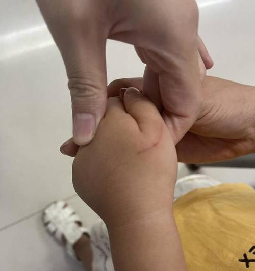 被宠物猫抓破了怎么办？（心理应对策略和伤口处理方法）