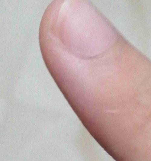 被宠物狗抓了一下怎么办？（应对措施及伤口处理方法，）