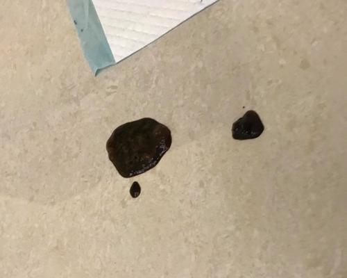 狗狗肚子硬胀拉稀，如何帮助宠物恢复健康（解读狗狗肚子硬胀拉稀的原因和治疗方法，让你的爱宠远离疾病）