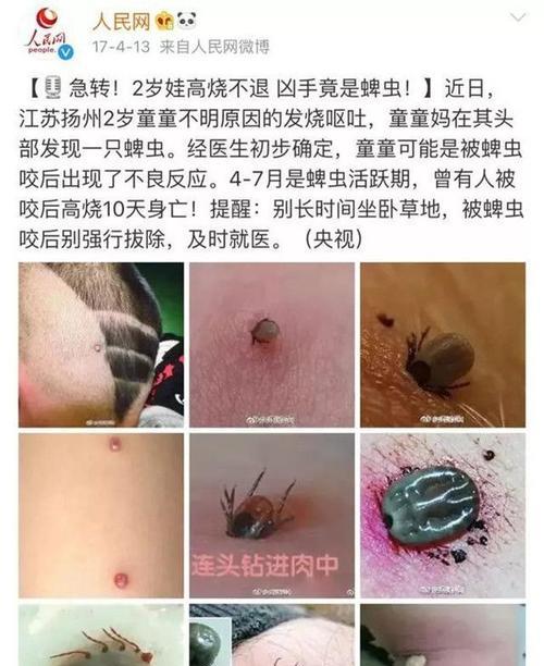 小狗身上有蜱虫怎么办？（宠物狗如何预防和处理蜱虫叮咬？）