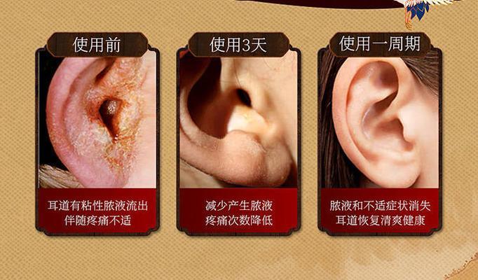 拉布拉多犬耳朵流脓处理方法（宠物养护专家分享，如何有效治疗耳朵流脓）