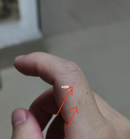 用手打小狗的后果（手被小狗抓破了怎么办，如何正确地对待宠物）