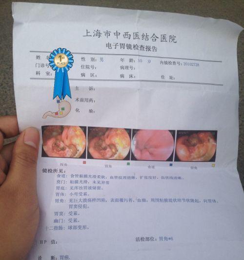 掌握肠胃炎病情的判定方法（了解肠胃炎病情程度的指标和评估方法）