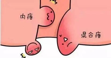 肛门颜色的健康秘密（探索正常肛门颜色的意义与健康指标）
