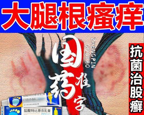 狗癣治疗方法及药膏推荐（选择适合的药膏治疗狗癣，保护宠物健康）