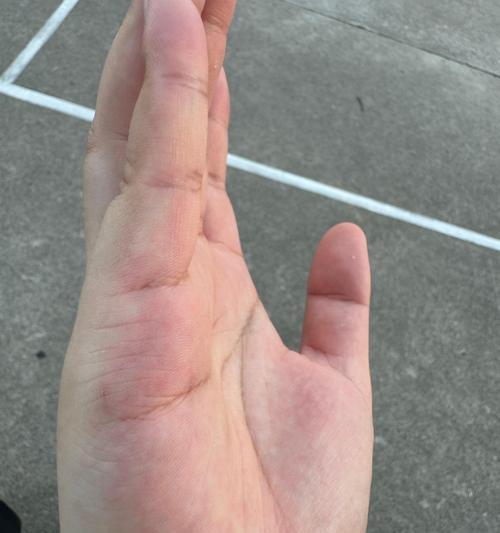 猫爪的危害及预防方法（被猫抓伤可能引发感染，正确处理十分重要）