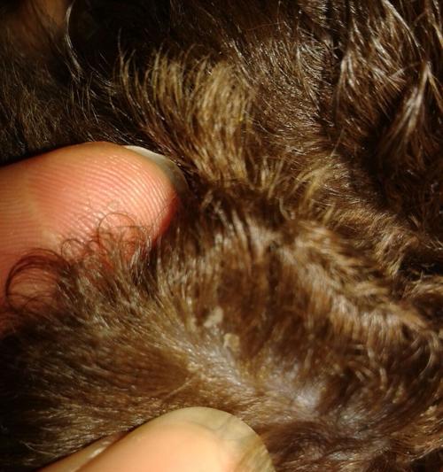 泰迪犬狗耳朵结痂的原因和治疗方法（解读泰迪犬耳朵结痂的病因和有效的治疗方案）