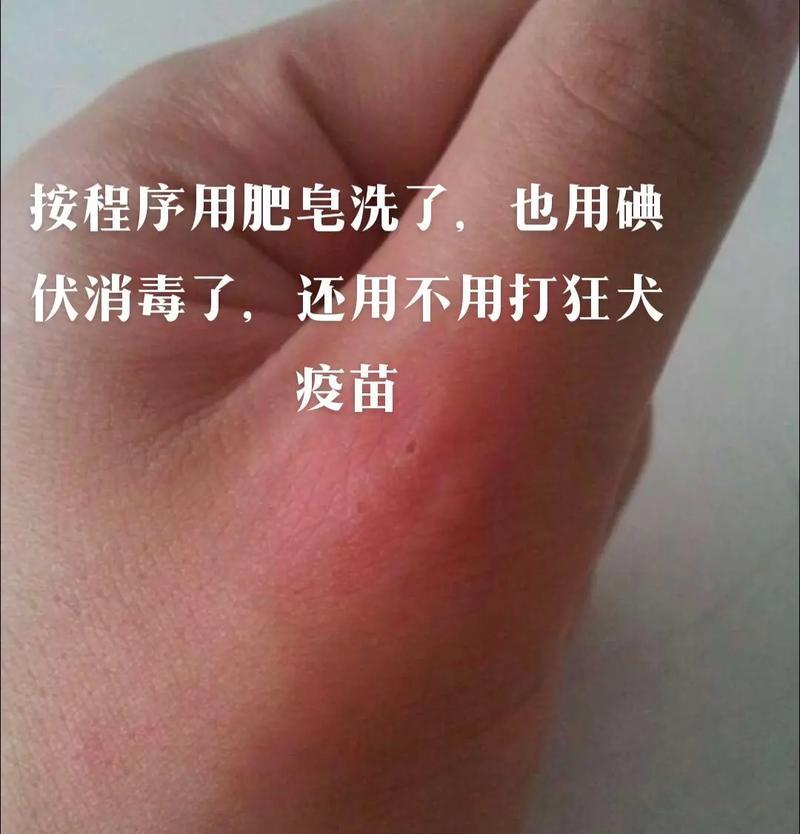 小狗咬手的危险与应对（揭示小狗咬手的原因及如何保护自己）