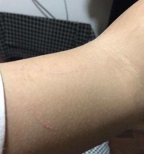 小狗抓了是什么样子？（揭开小狗抓人的真相及如何解决）