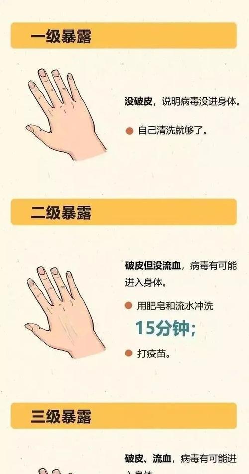 被狗咬了应如何接种狂犬疫苗（保护自己免受狗咬伤后的危险，及时接种狂犬疫苗）