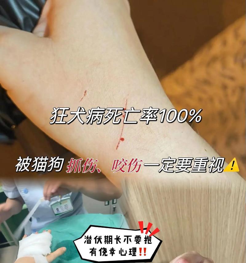 狂犬病毒（了解狂犬病毒的症状是保护自己和家人的第一步）