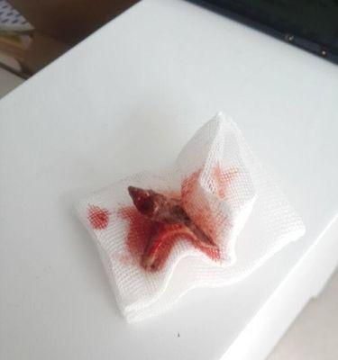 狗狗吃骨头后多久才能排出？（排出时间取决于骨头种类和狗狗消化系统的健康状况）